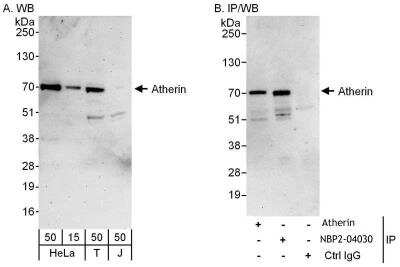 Immunoprecipitation: Atherin Antibody [NBP2-04030]