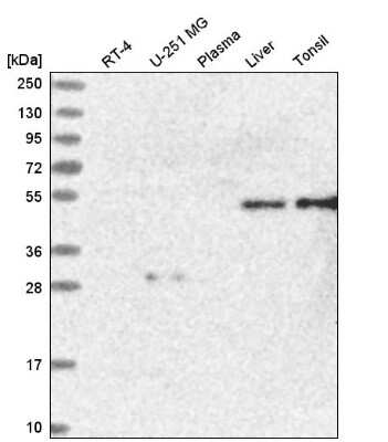 Western Blot: Atherin Antibody [NBP2-58972]