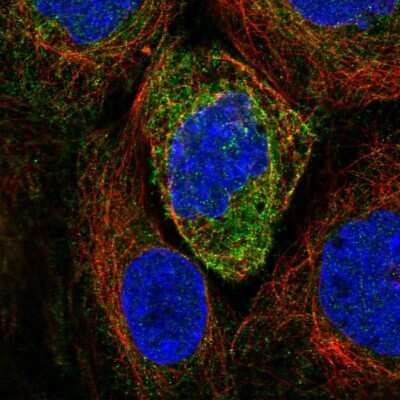 Immunocytochemistry/ Immunofluorescence: Atlastin-2 Antibody [NBP2-69006]