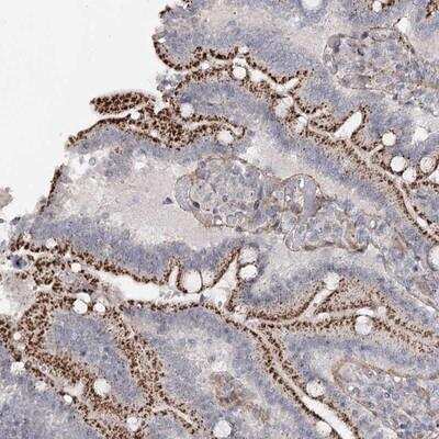 Immunohistochemistry: Atlastin-2 Antibody [NBP1-90102]