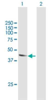 Western Blot: Atlastin-2 Antibody [H00064225-B01P]