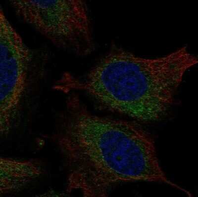 Immunocytochemistry/ Immunofluorescence: Atlastin-3 Antibody [NBP2-69023]