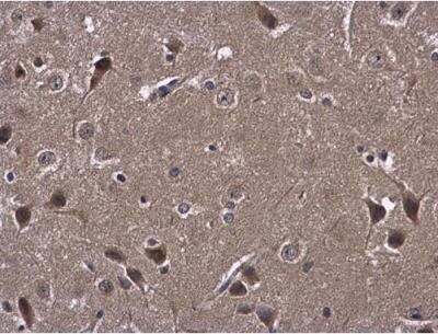 Immunohistochemistry-Paraffin: Atlastin-3 Antibody [NBP2-15508]