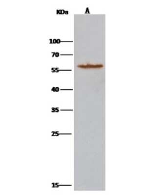 Immunoprecipitation: Atlastin-3 Antibody [NBP2-97067]