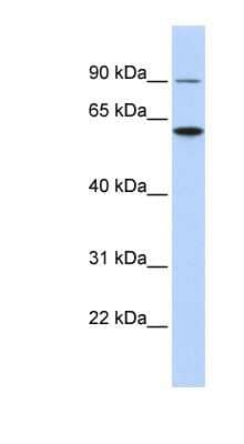 Western Blot: Atlastin-3 Antibody [NBP1-59034]