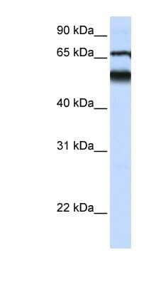 Western Blot: Atlastin-3 Antibody [NBP1-59035]