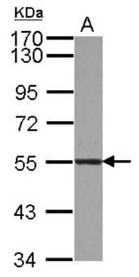 Western Blot: Atlastin-3 Antibody [NBP2-15508]