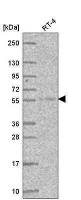 Western Blot: Atlastin-3 Antibody [NBP2-56000]