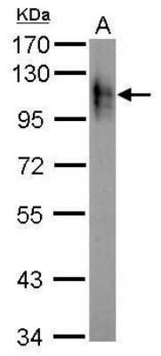 Western Blot: Atpalpha Antibody [NBP2-42817]