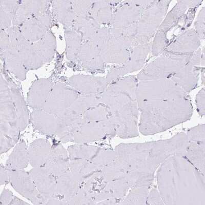 Immunohistochemistry-Paraffin: preproANP Antibody [NBP2-34105]