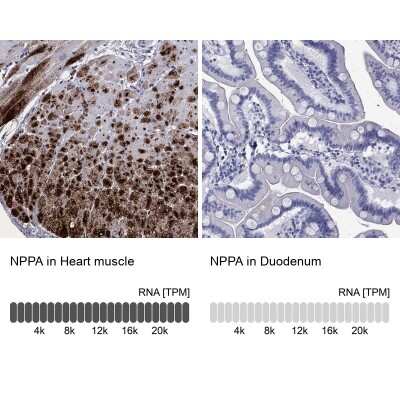 Immunohistochemistry-Paraffin: Atrial Natriuretic Peptide/ANP Antibody [NBP3-17073]