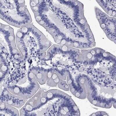 Immunohistochemistry-Paraffin: Atrial Natriuretic Peptide/ANP Antibody [NBP3-17073]