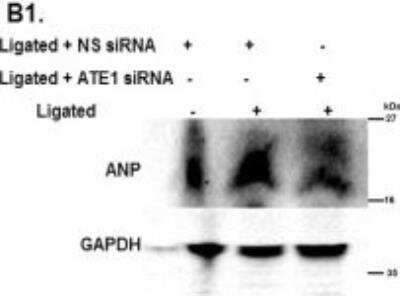Western Blot: preproANP Antibody [NBP2-14873]