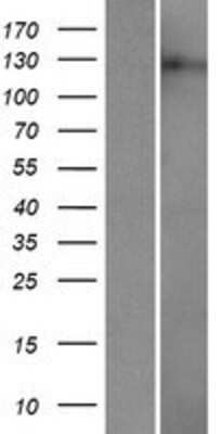 Western Blot: ATN1 Overexpression Lysate [NBP2-10761]