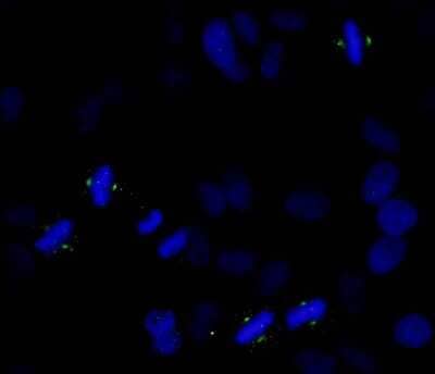 Immunocytochemistry/ Immunofluorescence: Aurora A [p Thr288] Antibody [NB100-2371]