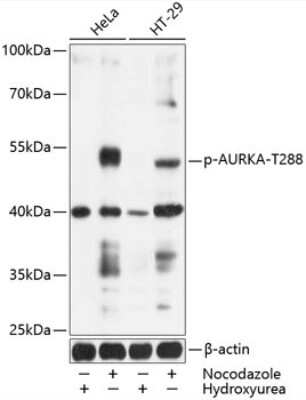 Western Blot: Aurora A [p Thr288] AntibodyBSA Free [NBP3-05434]