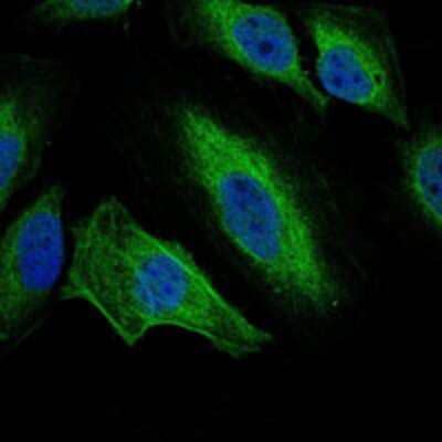 Immunocytochemistry/ Immunofluorescence: Aurora A Antibody (1F8) - BSA Free [NBP2-22118]