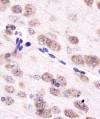 Immunohistochemistry: Aurora A Antibody - BSA Free [NBP1-51843]