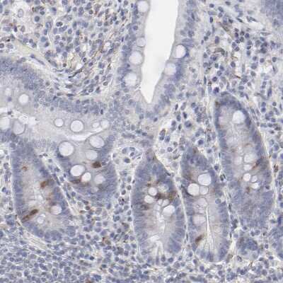 Immunohistochemistry-Paraffin: Aurora A Antibody [NBP1-90103]