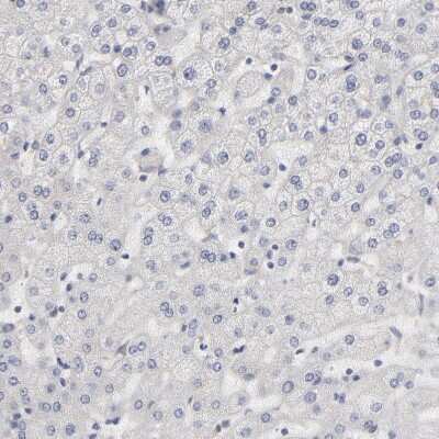Immunohistochemistry-Paraffin: Aurora A Antibody [NBP1-90103]