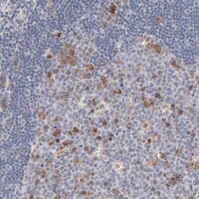 Immunohistochemistry-Paraffin: Aurora A Antibody [NBP1-90103]