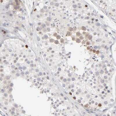 Immunohistochemistry-Paraffin: Aurora A Antibody [NBP1-90103]