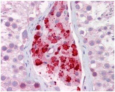 Immunohistochemistry-Paraffin: Aurora A Antibody [NBP2-36737]