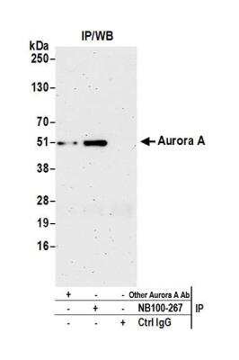 Immunoprecipitation: Aurora A Antibody [NB100-267]