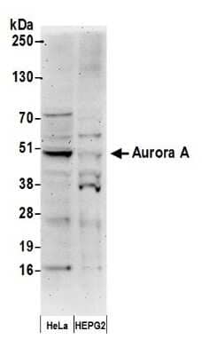 Western Blot: Aurora A Antibody [NB100-267]