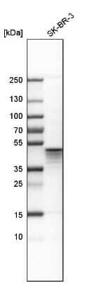 Western Blot: Aurora A Antibody [NBP1-90103]