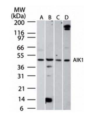 Western Blot: Aurora A Antibody [NBP2-36737]