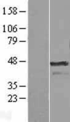 Western Blot: Aurora A Overexpression Lysate [NBL1-07856]