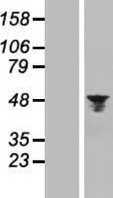 Western Blot: Aurora A Overexpression Lysate [NBL1-07857]