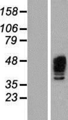 Western Blot: Aurora A Overexpression Lysate [NBP2-04699]