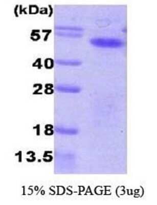 SDS-PAGE: Recombinant Human Aurora A His Protein [NBC1-28779]