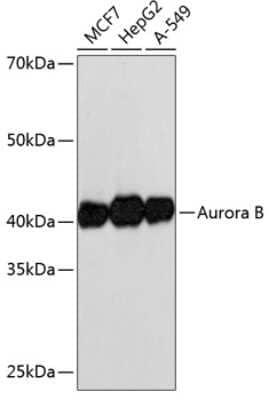 Western Blot: Aurora B Antibody (3C4V8) [NBP3-15762]