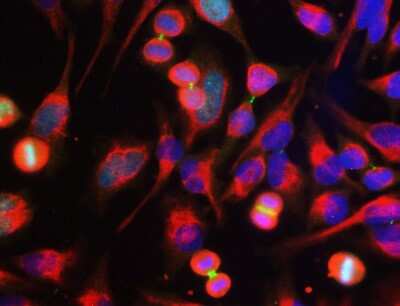 Immunocytochemistry/ Immunofluorescence: Aurora B Antibody (3F11) [NBP2-50039]