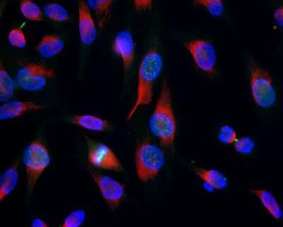Immunocytochemistry/ Immunofluorescence: Aurora B Antibody (6G2) [NBP2-50054]
