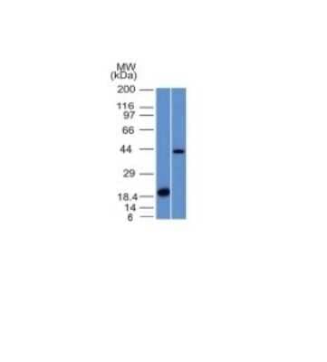 Western Blot: Aurora B Antibody (AURKB/1521) [NBP2-53267]