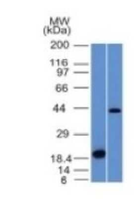 Western Blot: Aurora B Antibody (AURKB/1521)Azide and BSA Free [NBP2-54478]