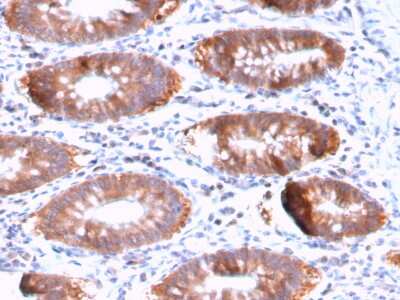 Immunohistochemistry-Paraffin: Aurora B Antibody (AURKB/3121R) - Azide and BSA Free [NBP3-08280]