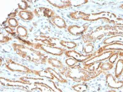 Immunohistochemistry-Paraffin: Aurora B Antibody (rAURKB/1592) - Azide and BSA Free [NBP3-08877]