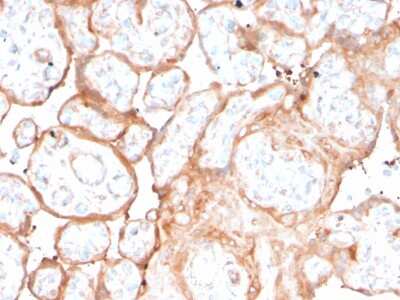 Immunohistochemistry-Paraffin: Aurora B Antibody (rAURKB/1592) - Azide and BSA Free [NBP3-08877]