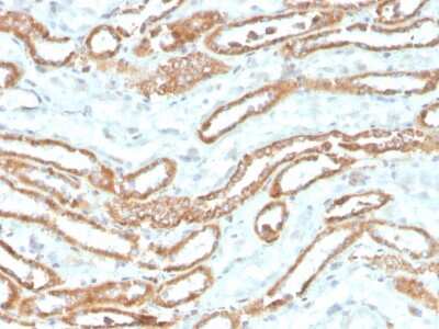 Immunohistochemistry-Paraffin: Aurora B Antibody (rAURKB/1592) [NBP3-07553]
