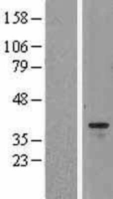 Western Blot: Aurora B Overexpression Lysate [NBL1-07860]