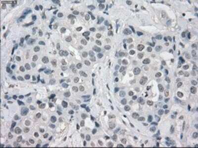 Immunohistochemistry-Paraffin: Aurora C Antibody (OTI2B7) [NBP1-47663]