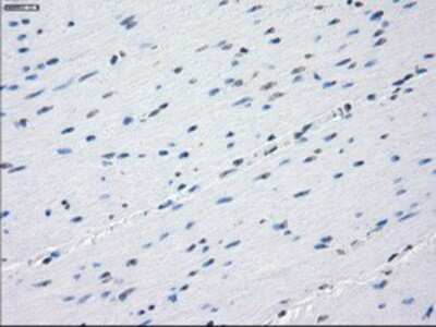 Immunohistochemistry-Paraffin: Aurora C Antibody (OTI2B7) [NBP1-47663]