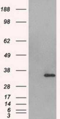 Western Blot: Aurora C Antibody (OTI2B7) [NBP1-47663]