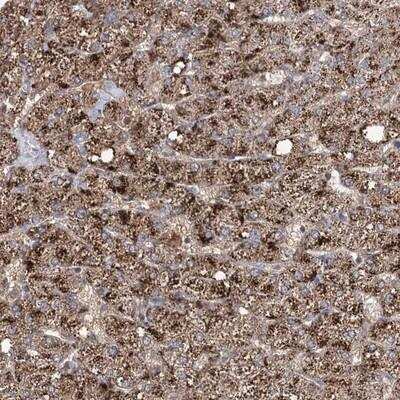 Immunohistochemistry: Aurora C Antibody [NBP1-90819]