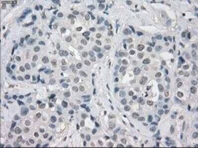 Immunohistochemistry: Aurora C Antibody (OTI2B7) - Azide and BSA Free [NBP2-71303]